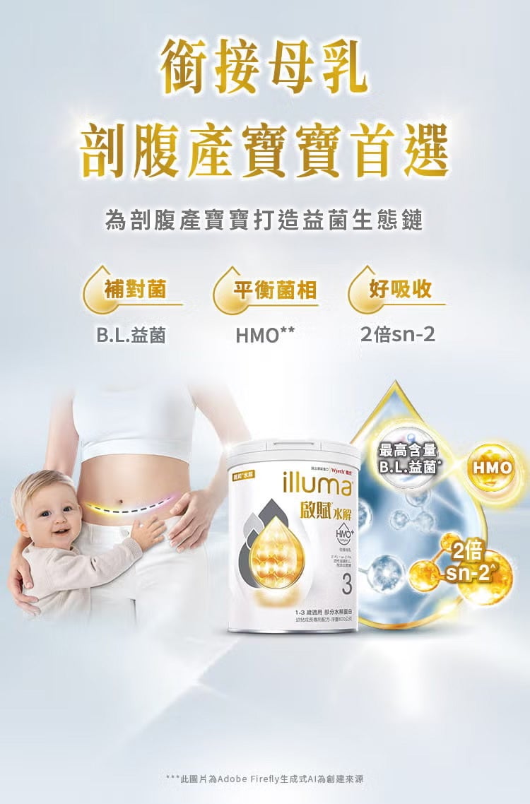 銜接母乳 剖腹產寶寶首選